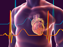 medyria_generic_400x300_2023.png