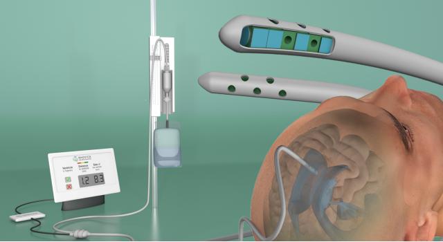 Swiss Startup - Rhovica Neuroimaging Profile Main Image